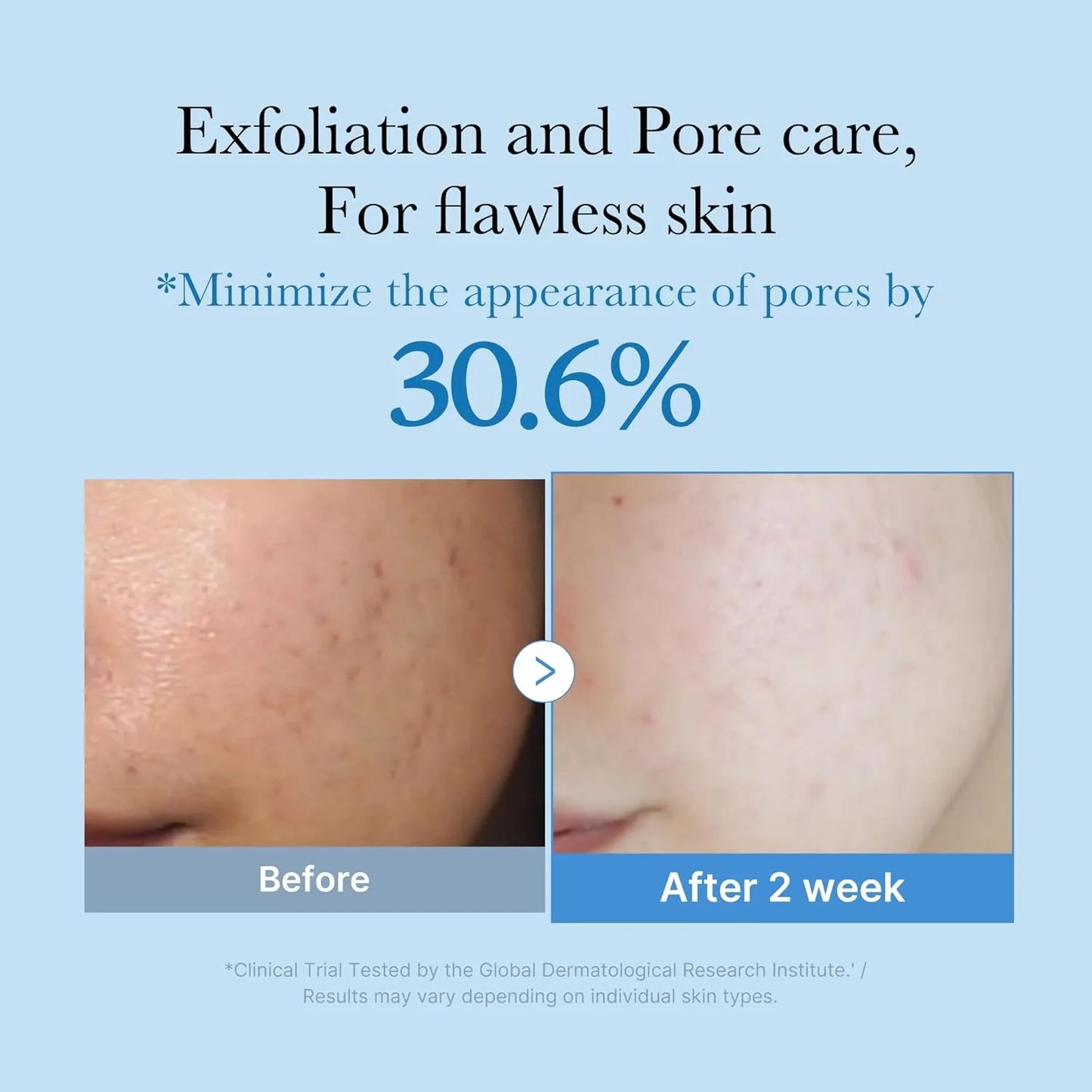 Zero Pore Toner – exfolieert & hydrateert zonder irritatie (250ml)