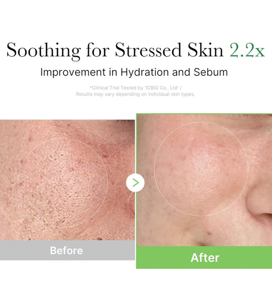 Exosome Cica Cream (50ml)