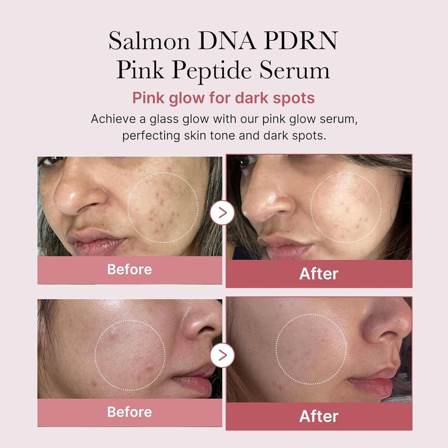 PDRN Pink Peptide Serum (30ml)