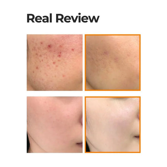 Propolis B5 Glow Barrier Calming Cream 60g – Kalmerend & Verhelderend