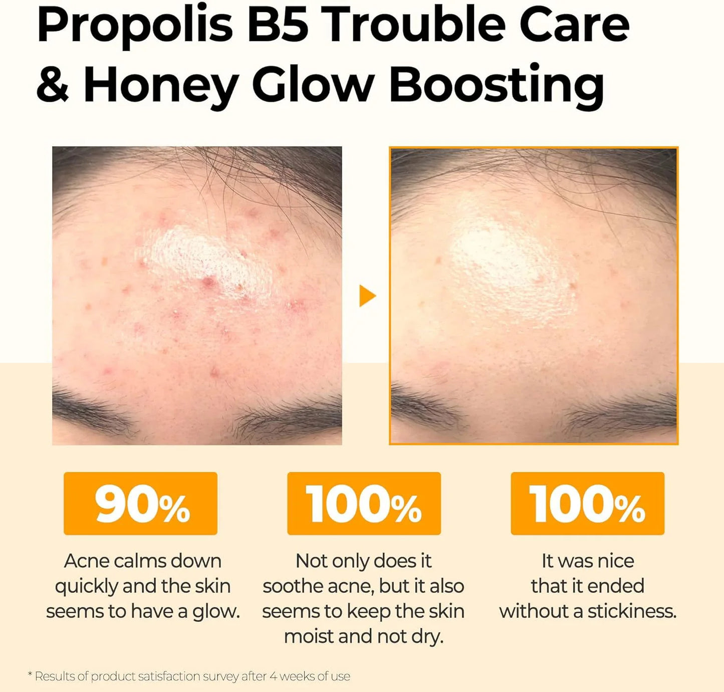 Propolis B5 Glow Barrier Calming Toner 150ml – Kalmerend & Barrièreherstellend