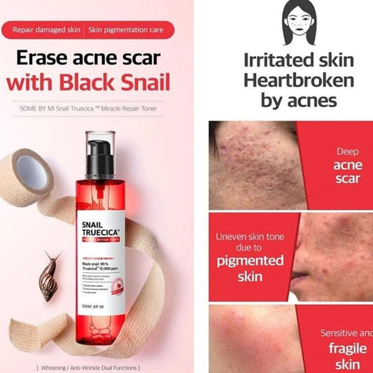 Snail Truecica Miracle Repair Toner 150ml – Kalmering & Littekens