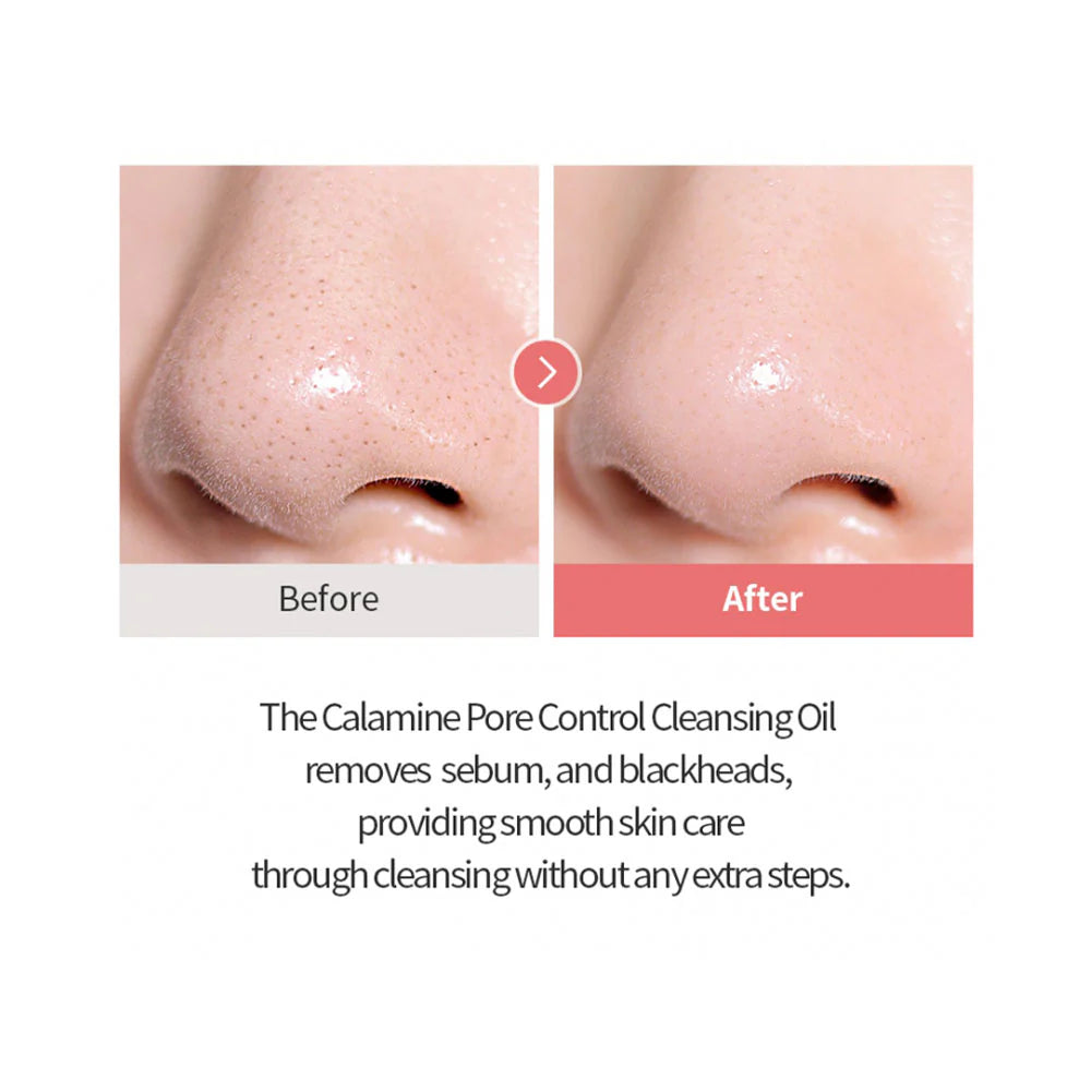 Calamine pore Control Cleansing Oil 20ml | absobeert talg