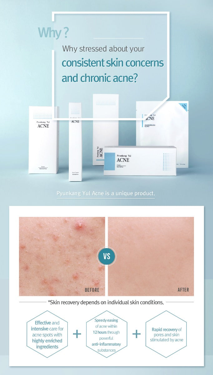 ACNE Spot Cream – kalmeert puistjes binnen 12 uur (15ml)