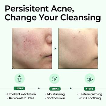 AHA.BHA.PHA 30 Days Miracle Cleansing Bar 106g