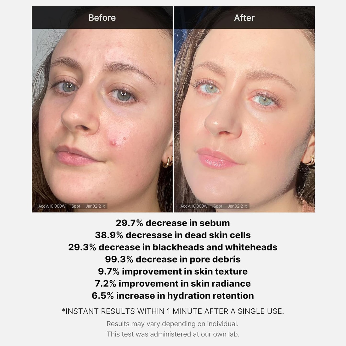 RED Succinic Acid Clarifying Serum 30ml