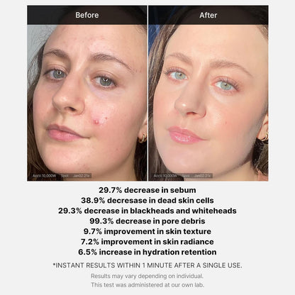 RED Succinic Acid Clarifying Serum 30ml