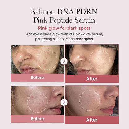 PDRN Pink Peptide Serum (30ml)