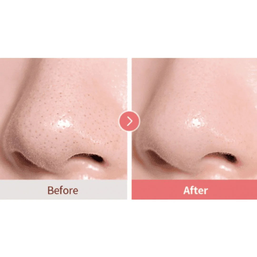 Calamine pore Control Cleansing Oil 2ml